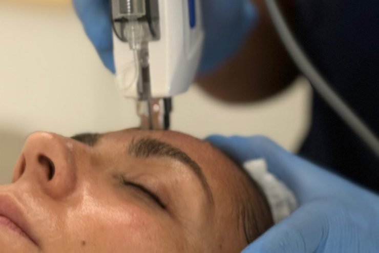 Estetica facial avanzada